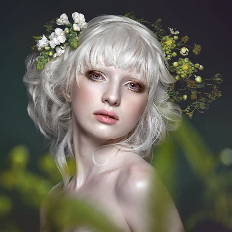 Nastya Zhidkova Model Albinisme Paling Terkenal Di Dunia