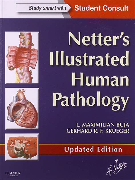 Netters Illustrated Human Pathology Updated Edition Vasiliadis