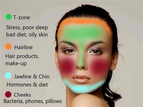 Acne Face Map What Spots In Different Areas Mean