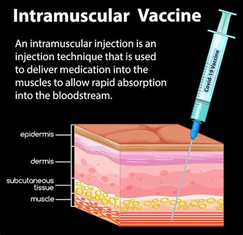 Free Vector Information On Intramuscular Injection