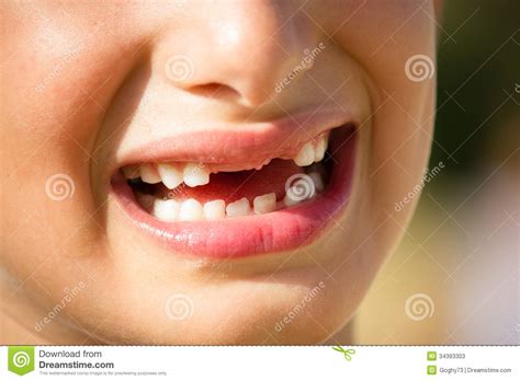 Child With Toothless Smile Stock Photos Image 34393303