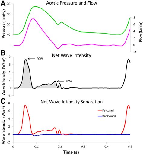 Wave intensity analysis of representative waveforms. A: Representative ...
