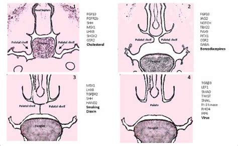 Developmental Process Of Formation Of The Palate The Four Stages Of