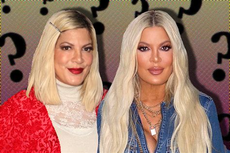 Plastic Surgeons Reveal What Work Tori Spelling May Have Had Done