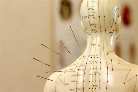 Zhangs Acupuncture Westport Ct