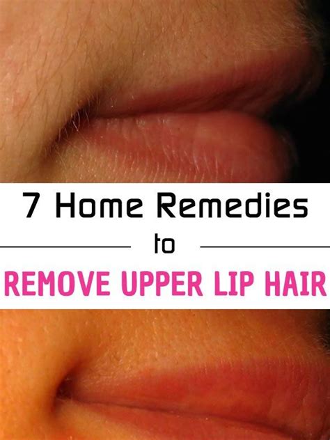 How To Remove Hair From Your Upper Lip With 7 Home Remedies Upper Lip Hair Upper Lip Lip Hair