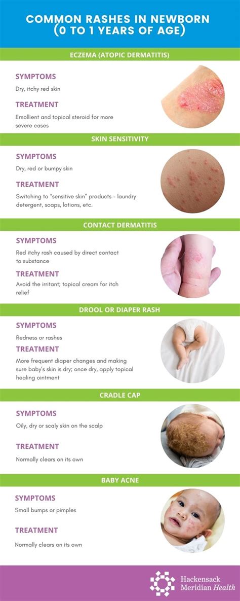 Visual Guide To Children S Rashes And Skin Conditions