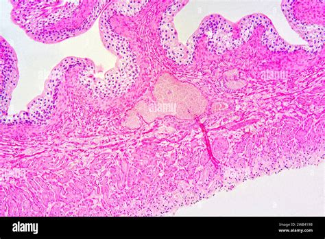 Urinary Bladder With Urothelium Transitional Epithelium Connective