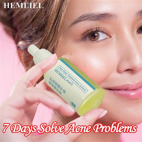 Hemeiel Sos Pimple Removeracne Treatment Serumbenzac Benzoyl Peroxide