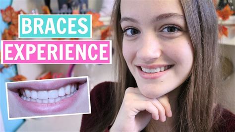My Braces Experience Tips And My Advice Youtube
