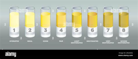 Urine Color Chart Lab Tubes With Different Urine Colors Samples