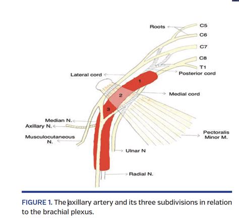 Totally Percutaneous Insertion And Removal Of Impella Device Using