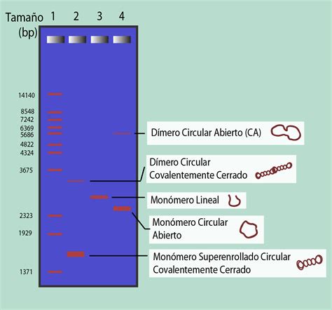 Cómo Interpretar Resultados De Electroforesis En Gel De Adn Goldbio