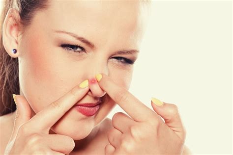 Blind Pimple On Nose 6 Quick Fixes Science Becomes Her