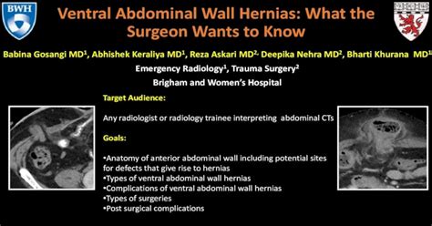 Ventral Abdominal Wall Hernias What The Surgeon Wants To Know