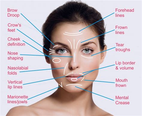 Botox Treatment For Wrinkles India Botox Injection Cost