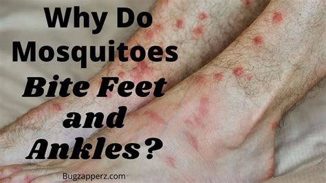 Why Do Mosquitoes Bite Ankles Bug Zapperz