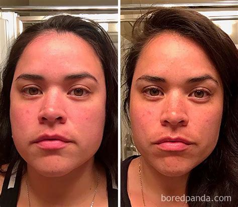 These Drastic Before After Photos Of People Who Quit Alcohol Will