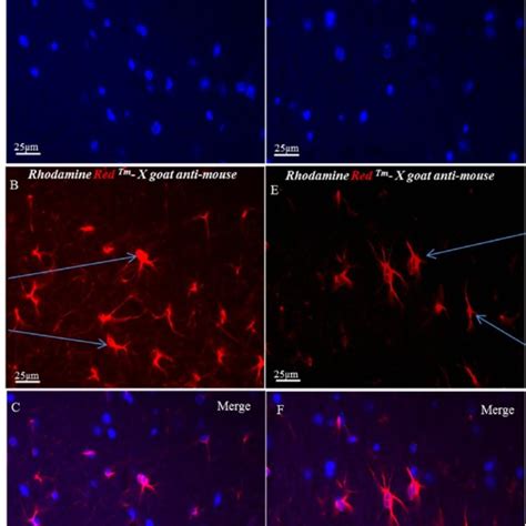 Immunohistochemical Staining Of Gfap Through The Cortical Region Of A