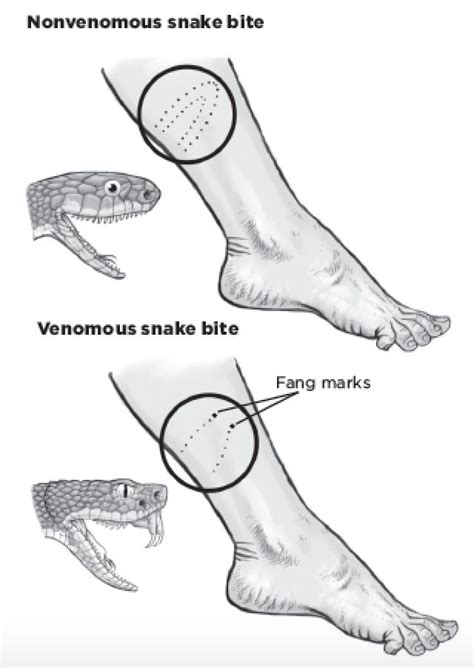 How To Identify A Venomous Snake By Its Bite Survival Skills