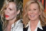 Has Kim Basinger Had Plastic Surgery Before And After Photos