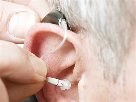 Hearing Aids A Luxury Good For Many Seniors Health News Florida