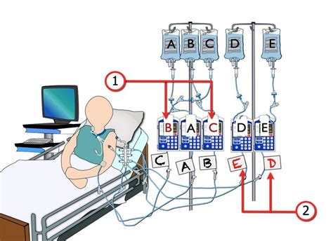 Setting Up And Programming Multiple Primary Continuous Iv Infusions