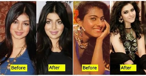 11 Bollywood Actresses Who Have Undergone Plastic Surgery