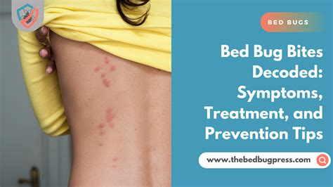 Bed Bug Bites Decoded Symptoms Treatments And Prevention Tips