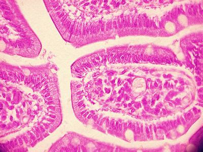 Small Intestine Histology Jejenum Histology Slide