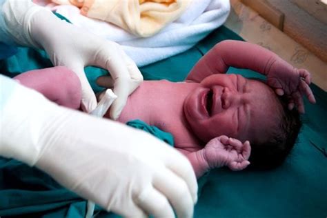 A Nurse Shares What They Wish Parents Knew About Circumcision