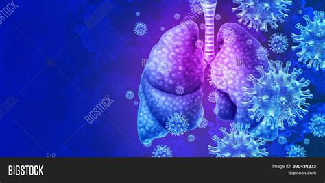 Lungs Virus Image And Photo Free Trial Bigstock
