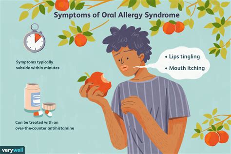 Oral Allergy Syndrome Symptoms And Treatment Hot Sex Picture