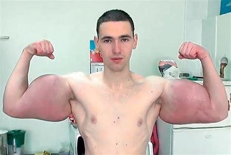 this russian bodybuilder with 24 inch biceps could lose his arms