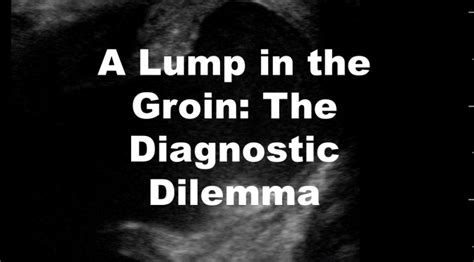 Emergency Medicine Educationa Lump In The Groin The