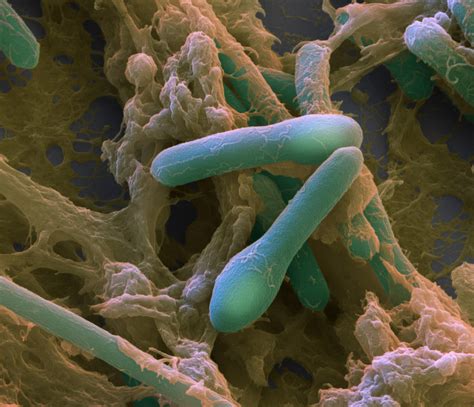 Clostridium Botulinum Sem Photograph By Eye Of Science Fine Art America