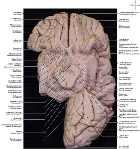 Iv Neuroanatomy And Cranial Base Neupsy Key