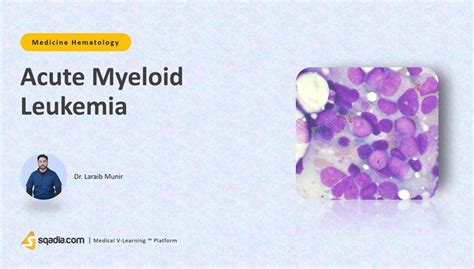 Acute Myeloid Leukemia Hematology Lecture V Learning