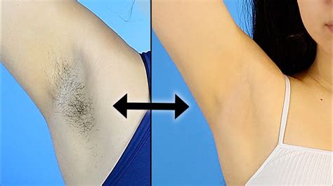 But with development of science, no problem has no solution anymore, and underarm hair removal is one of the easiest areas now! My ARMPIT ROUTINE | Hair Removal & Preventing Dark ...