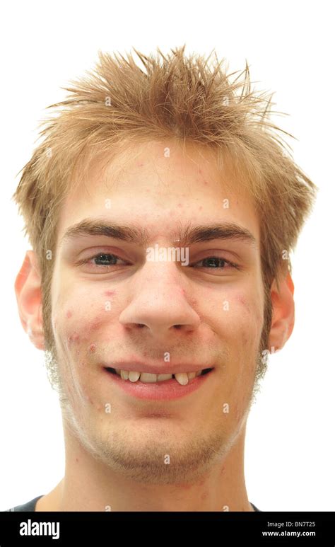 Man Trying To Smile With Crooked Teeth Isolated On White Stock Photo