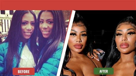 Clermont Twins Before And After Pictures How Does The Twins Look After