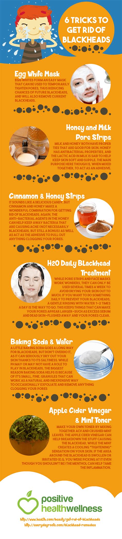 6 Tricks To Get Rid Of Blackheads Infographic