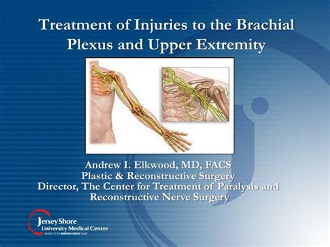 Ppt Treatment Of Injuries To The Brachial Plexus And Upper Extremity