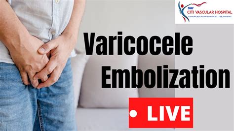 Varicocele Varicocele Embolization Live Video In India By Varicocele Expert Youtube
