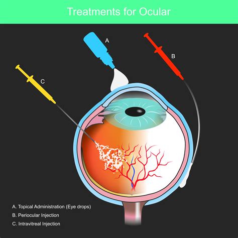 Eye Conditions And Treatments Rashmi Akshikar