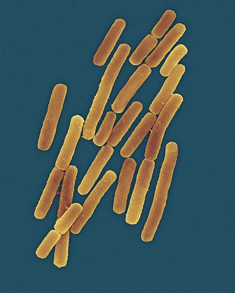 Clostridium Difficile 1 Photograph By Dennis Kunkel Microscopyscience