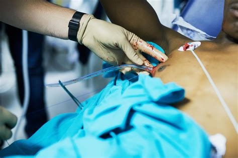 Chest Tube Insertion Uses Procedure And Recovery
