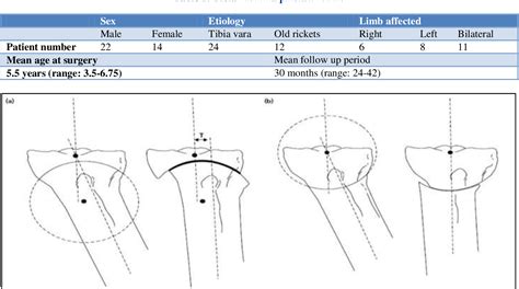 Table 1 From Modified Dome Shaped Proximal Tibial Osteotomy For