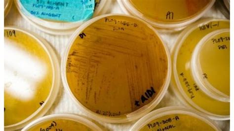 Mrsa Hospital Superbug Shared With Pets Bbc News