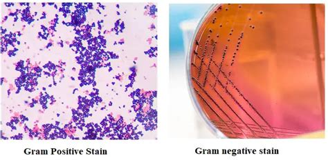 25 Differences Between Gram Positive And Gram Negative Bacteria